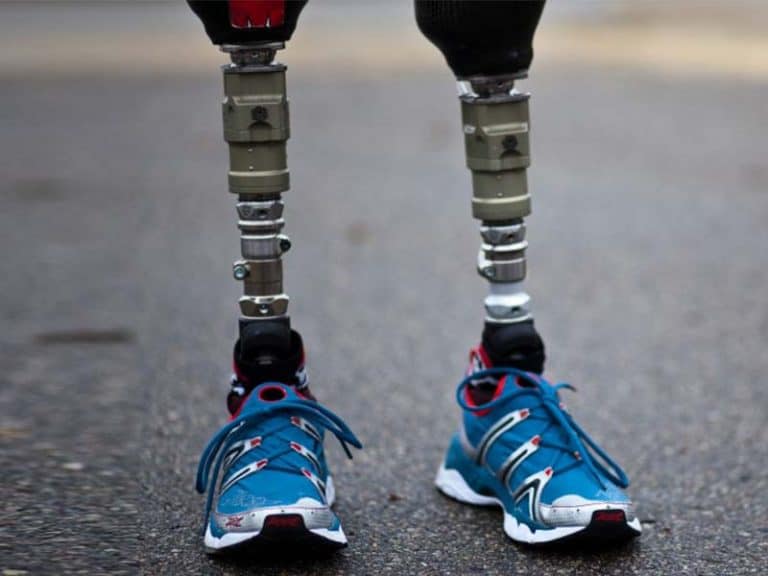 Artificial Leg Prototype Medical Prototyping DDPROTOTYPE